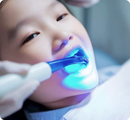 예방치료(불소, 홈메우기) 이미지