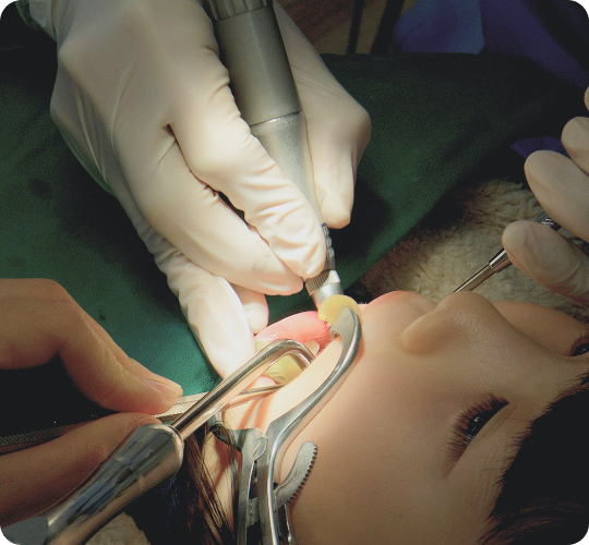 구강외과 소수술 이미지